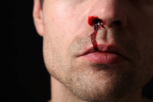 *THIS IS NOT REAL - SPECIAL EFFECTS MAKE UP* Close up of man with nose bleed